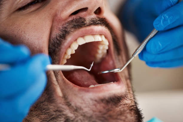 Best Emergency Wisdom Teeth Removal in Guttenberg, IA